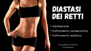 Diastasi